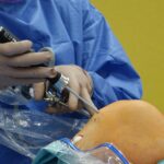 Surgeon using arthroscope for precise knee surgery in operating room.