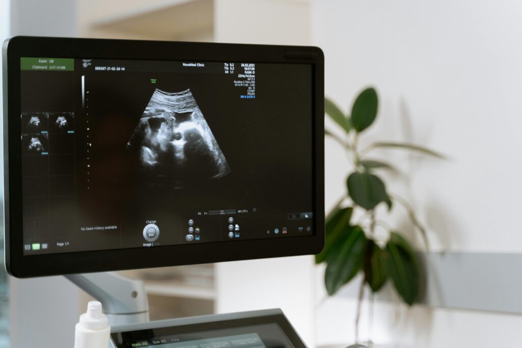 pexels photo 7088840 7088840 Medical ultrasound scan showing a fetus on a monitor in a clinic setting.
